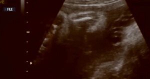 1786661146005_nn_rch_surrogate_baby_custodybattle_260813_S3_1920x1080-axwpz2.jpg